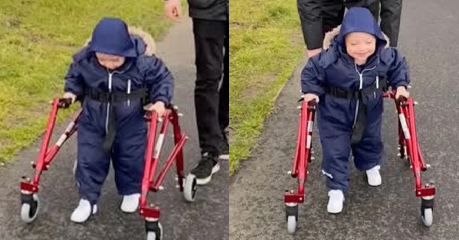 Ήρωας μόλις 2 ετών: Ο μικρός Μπόμπι με εγκεφαλική παράλυση και επιληψία περπατά για πρώτη φορά