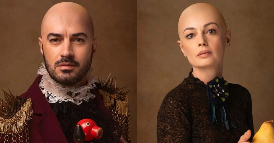 Συγκίνηση από αυτή την πρωτοβουλία: Αγαπημένοι ηθοποιοί φωτογραφίζονται χωρίς μαλλιά για καλό σκοπό