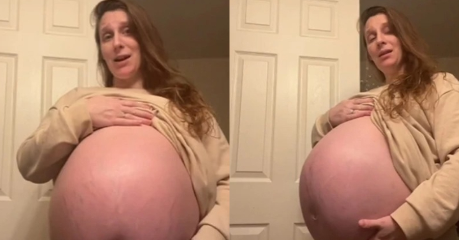 Viral εγκυμονούσα: Είναι έγκυος 37 εβδομάδων και η κοιλιά της είναι ασύλληπτη – Κανείς δεν πιστεύει αυτό που βλέπει
