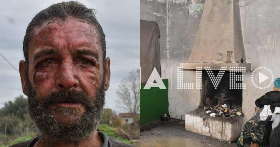 Οι ειδήσεις δεν θα το δείξουν: Τα Χριστούγεννα ενός άπορου στην Ηλεία σε καμένο σπίτι, χωρίς ρεύμα και νερό