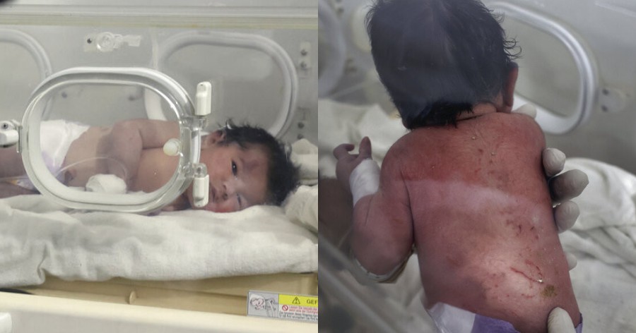 Γεννήθηκε ζωή μέσα από τον θάνατο: Το βρέφος που γεννήθηκε στα χαλάσματα του σεισμού αναρρώνει στο νοσοκομείο