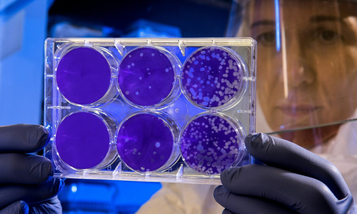 Συναγερμός τώρα για νέα πανδημία: Ο ιός που αντέχει στο ανοσοποιητικό