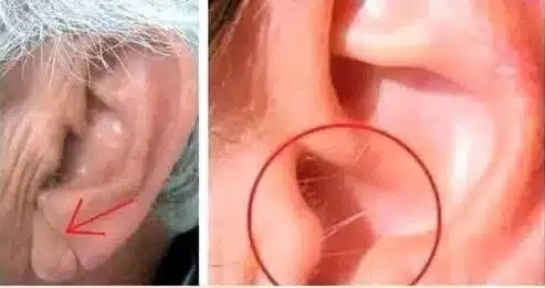 Να γιατί μεγαλώνουν τρίχες στα αυτιά σας