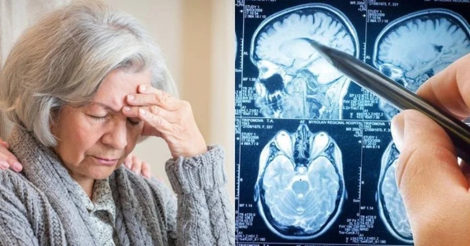 Άνοια: Η πασiγνωστη βιταμiνη που σώζει το μυαλό των 80ρηδων