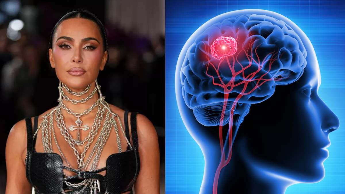 Με Avεupuσμα στον εγκέφαλο διαγνώστηκε η Κιμ Καρντάσιαν – Τα Yπouλα συμπτώματα κι οι τεχνικές αντιμετώπισης