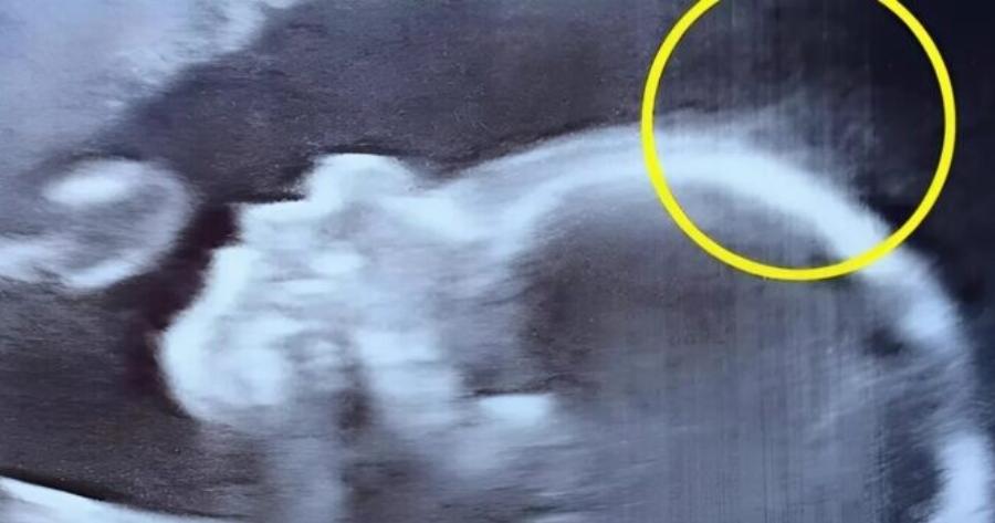 Κατά τη διάρκεια του υπερηχογραφήματος, ένα συγκλονιστικό μυστήριο… και στη συνέχεια, κατά τη γέννηση της μικρής Άιβι, μια μαγική ανακάλυψη που εκπλήσσει τους πάντες.