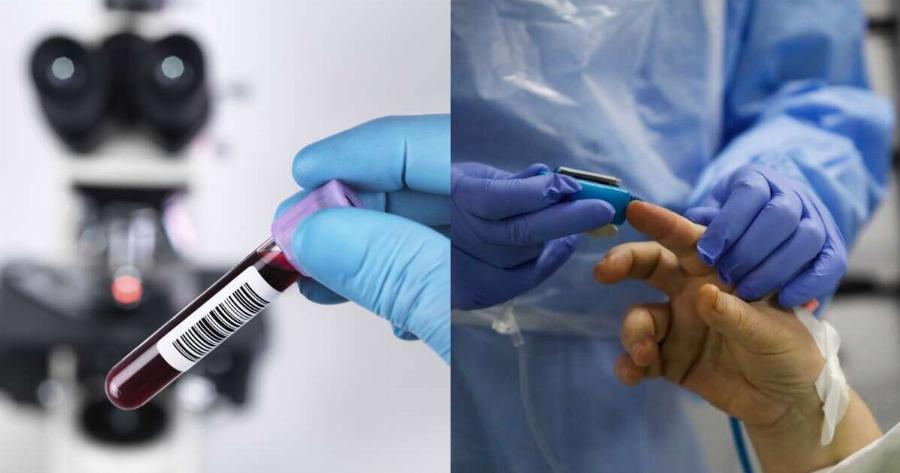 Ελάχιστοι το γνωρίζουν: Γιατί οι άνθρωποι με ομάδα αίματος 0 είναι τόσο ξεχωριστοί;