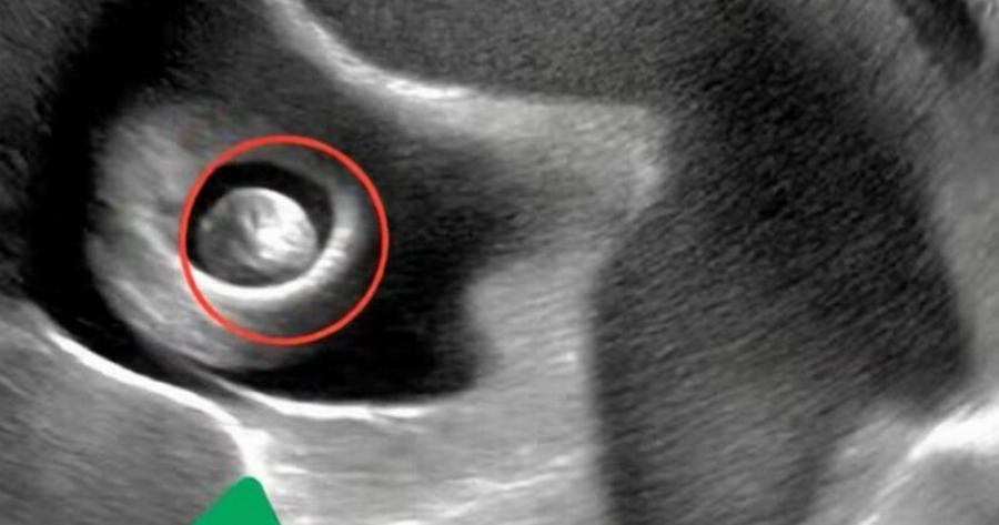 Ζήτησα από τη γειτόνισσά μου να προσέχει την κόρη μου μόνο για είκοσι λεπτά, όσο θα έκανα μερικές γρήγορες δουλειές. Όταν όμως γύρισα, βρήκα τη Σοφία να ουρλιάζει από πόνο στην κοιλιά. Ο γιατρός στο νοσοκομείο έδειχνε σοκαρισμένος