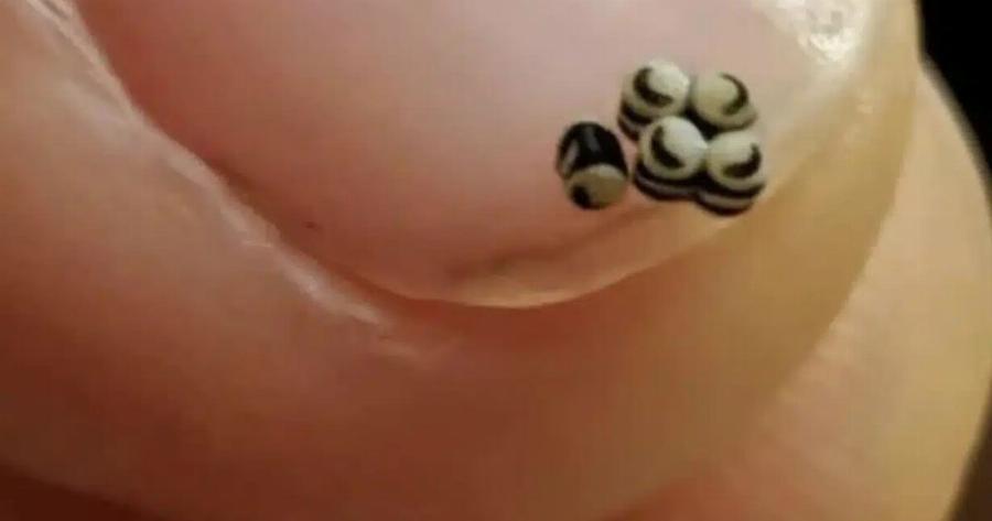 Παραγγείλαμε μια σαλάτα, αλλά υπήρχαν αuτά τα μικρά μαύρα στο φαγητό – Πήγαμε κατευθείαν στο νοσοκομείο