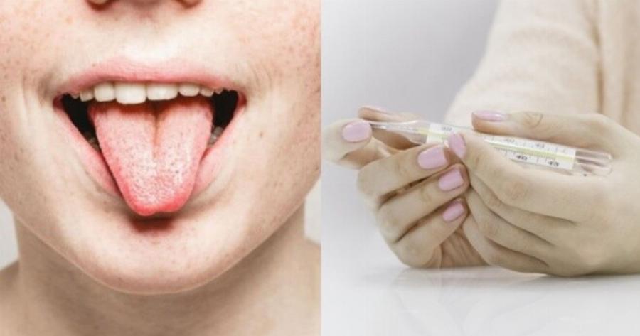 Προσοχή γιατί συμβαίνει πολύ: Τι σημαίνει πραγματικά όταν η γλώσσα μας έχει μια λευκή απόχρωση πάνω της