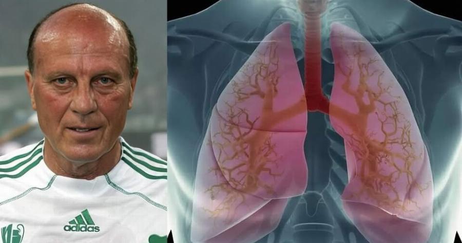 Αυτή είναι η αιτία θανάτου του Μίμη Δομάζου!