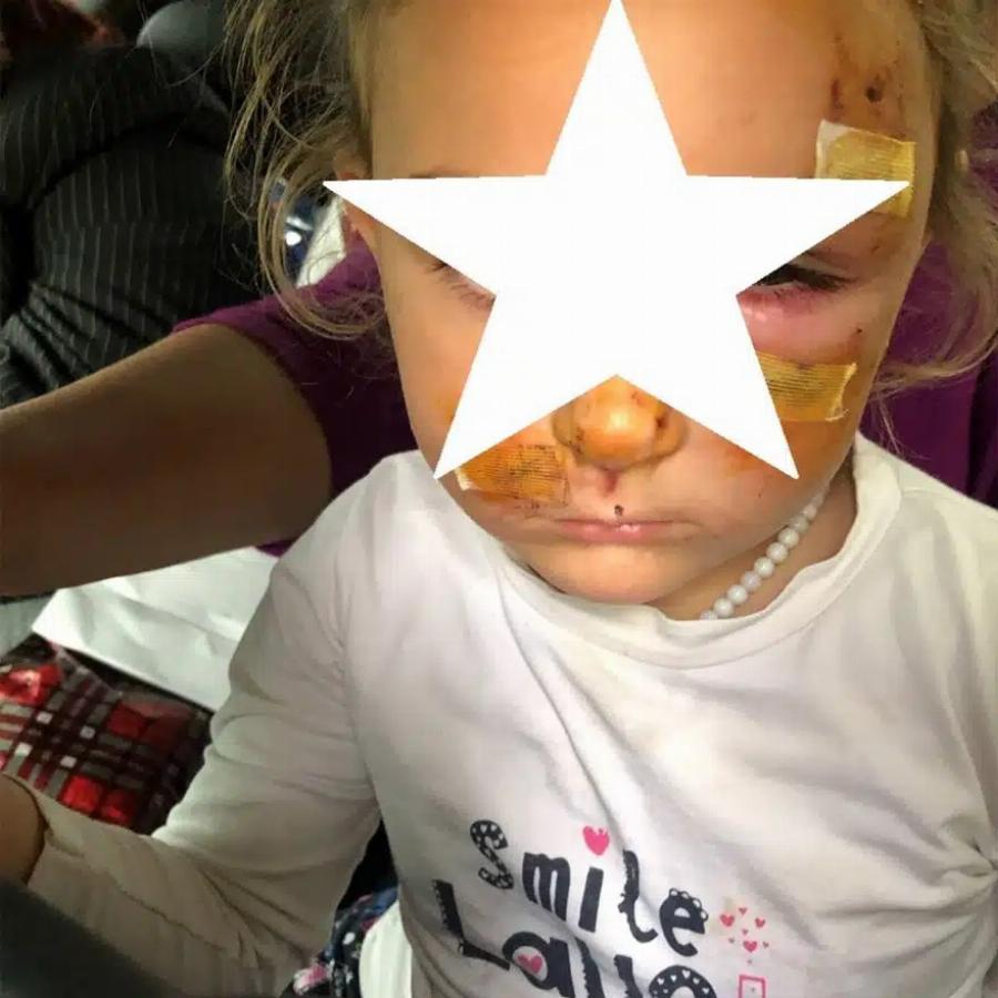 Την κατασπάραξε: Αυτή είναι η άτυχη 5χρονη που της επιτέθηκε σκύλος έξω από το σπίτι της στο Αγρίνιο