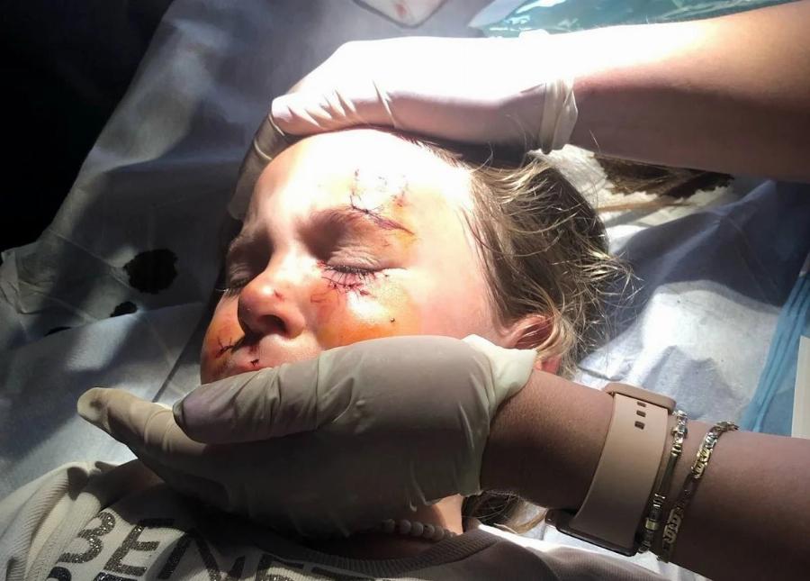 Την κατασπάραξε: Αυτή είναι η άτυχη 5χρονη που της επιτέθηκε σκύλος έξω από το σπίτι της στο Αγρίνιο