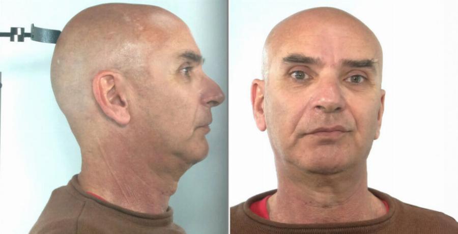 Σαλαμίνα: Αυτός είναι ο 58χρονος που ασέλγησε σε ανήλικη με βαριά αναπηρία