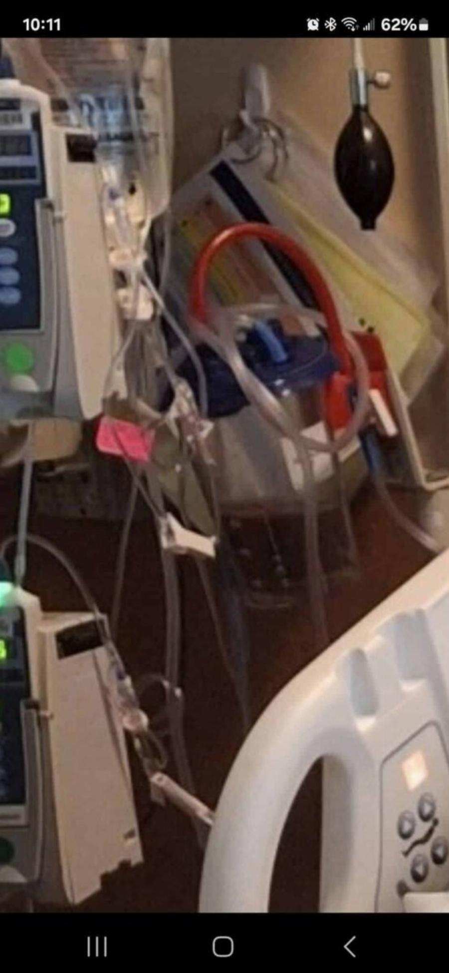 Έβγαλαν δύο λίτρα μαύρου υγρού από τους πνεύμονες 32χρονης που έκανε ηλεκτρονικό τσιγάρο