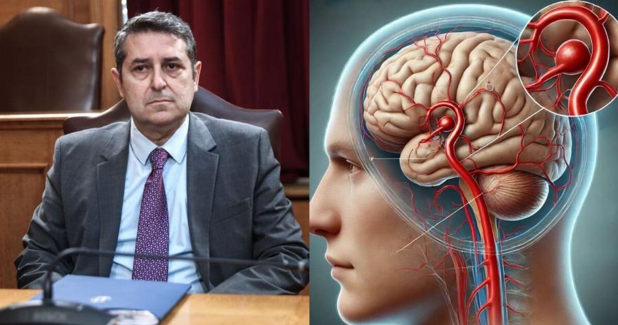 Τι είναι το εγκεφαλικό ανεύρυσμα που έπαθε ο Γιώργος Μυλωνάκης: Τα συμπτώματα και οι κίνδυνοι