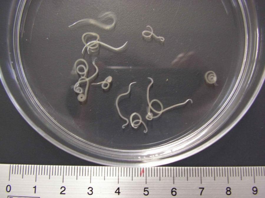 Καταγράφηκε η πρώτη μόλυνση ανθρώπου από κατανάλωση σούσι στην Ελλάδα