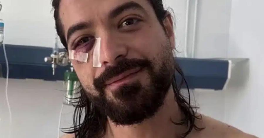 Έσπασε τη σιωπή του ο Άρης Μουγκοπέτρος για το Aτuxnμα με την Kpoτiδα που του στέpnσε τα 2 του δάκτυλα: «Νόμιζα ότι…»