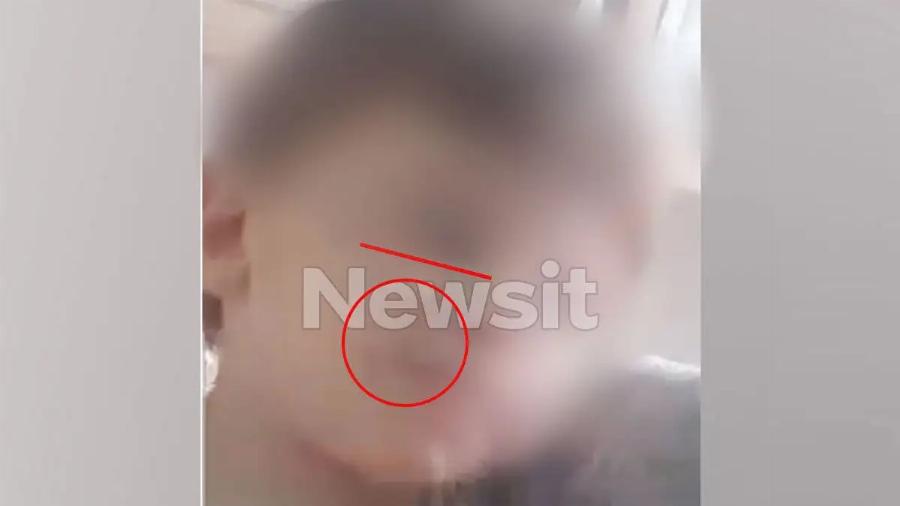 Ηράκλειο: Η 26χρονη μάνα ανέβαζε βίντεο στο Tiktok με τα σημάδια της κακοποίησης στο προσωπάκι του 3χρονου Άγγελου – Δείτε το βίντεο-σοκ