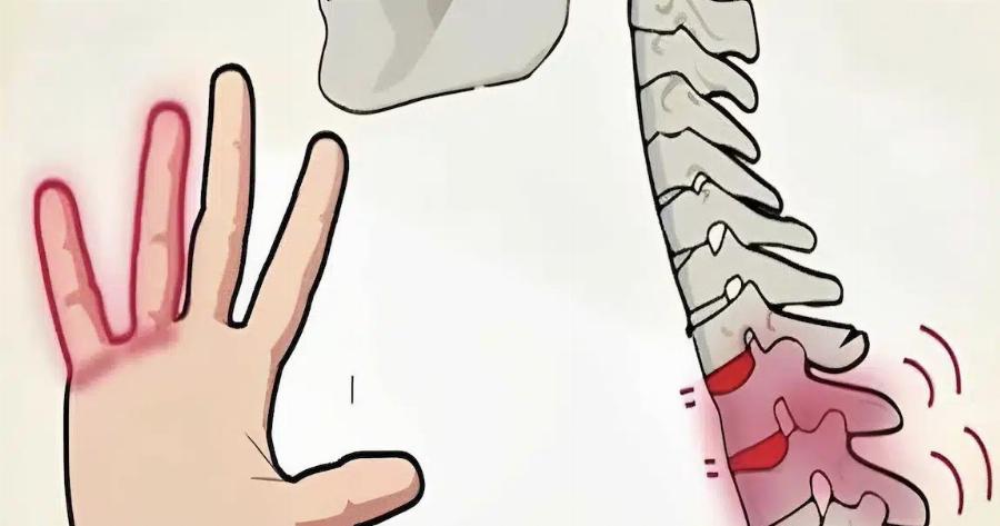 Μουδιασμένα χέρια: Είναι φυσιολογικό ή σημάδι πpoBλnματoς;