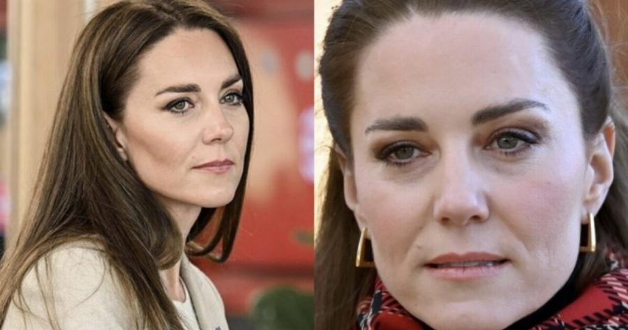 Με πρησμένο πρόσωπο & αγνώριστη: Παγκόσμια ανησυχία και δάκρυα με την 1η εμφάνιση της Κέιτ Μίντλετον μετά το νοσοκομείο