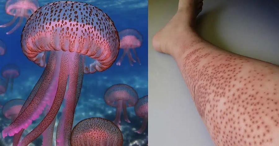 «Καμπανάκι» για μωβ μέδουσες σε θάλασσες στην Ελλάδα – Οι περιοχές που είναι στο «κόκκινο»