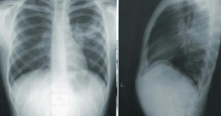 Ο «τιμοκατάλογος» του υπουργείου Υγείας: Τόσο το κόστος για κάθε ακτινογραφία και τόσο για το παραπεμπτικό για αίματος