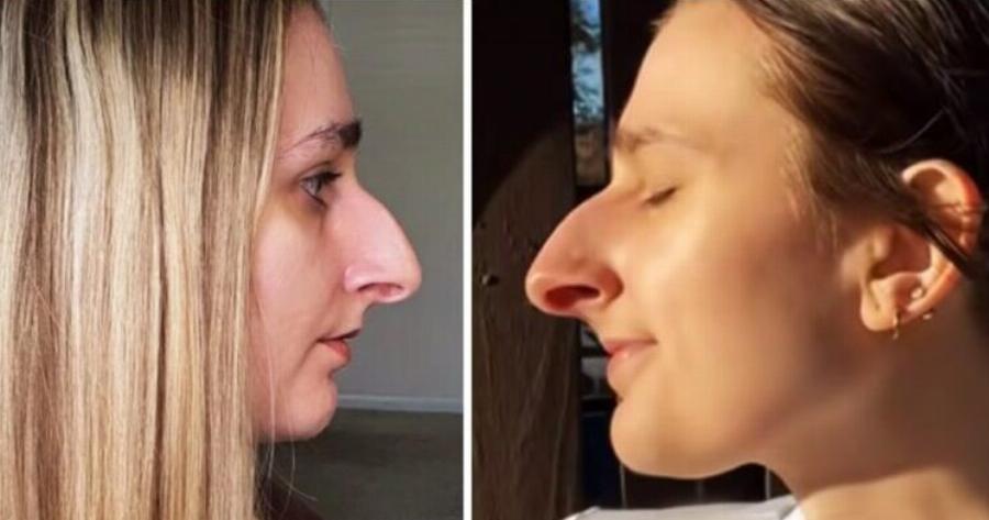 Ο φίλος της της έθεσε έναν όρο: «Θα σε παντρευτώ αφού κάνω πλαστικn στη μύτη μου» — Αλλά Auτo που έκανε η κοπέλα, δεν το περίμενε κανείς
