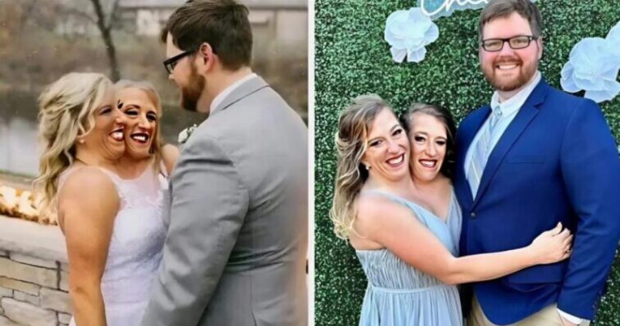 Σιαμαίες δίδυμες που παντρεύτηκαν τον ίδιο άντρα έδειξαν φωτογραφίες με τον σύζυγό τους και την κόρη τους