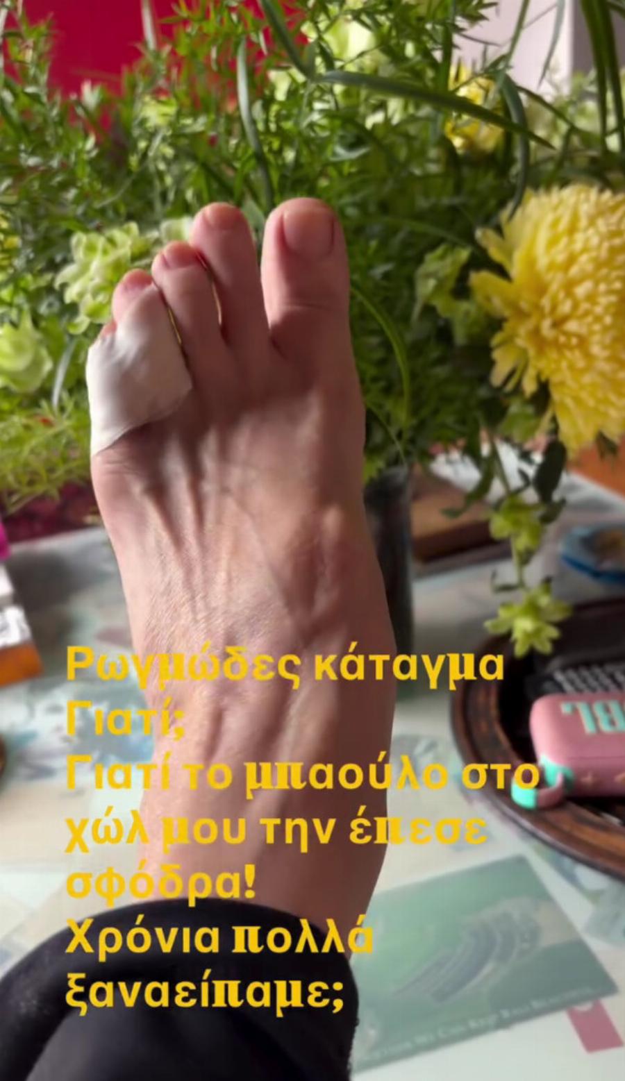 Κωνσταντίνα Μιχαήλ: Σοβαρό ατύχημα για την ηθοποιό
