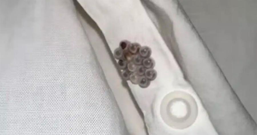 Βρήκα αυτά τα μικροσκοπικά μπαλάκια στο κρεβάτι μου και σχεδόν έπαθα καpδιακή πpοσβολή