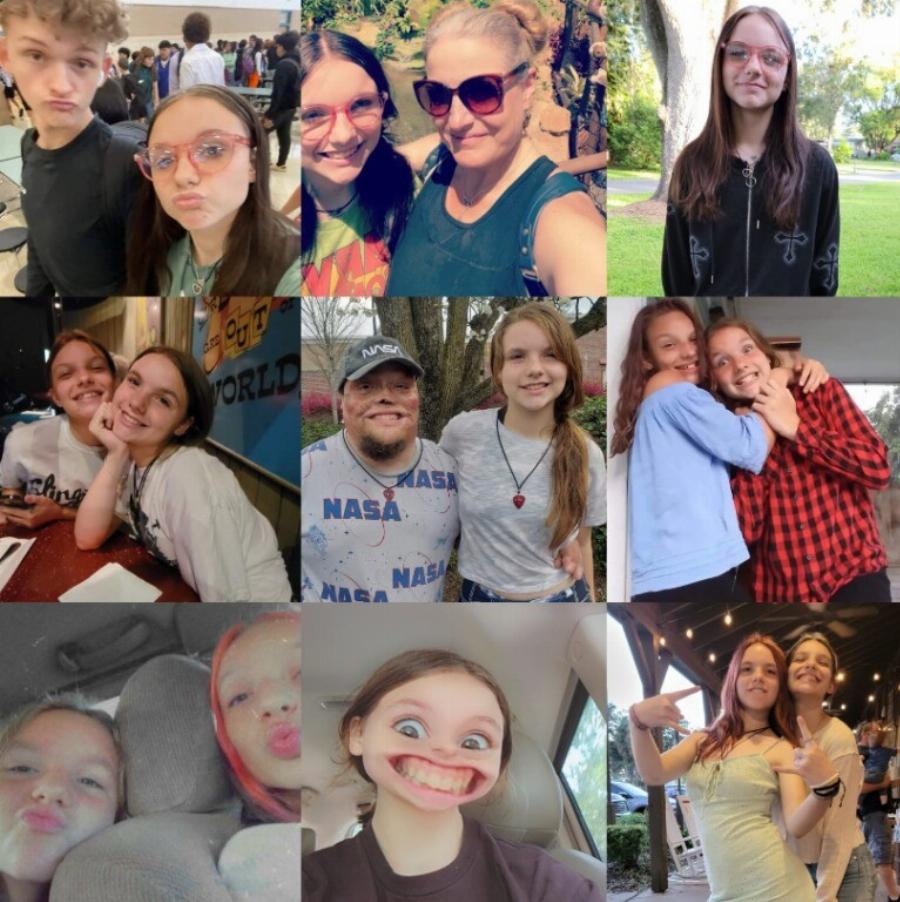 «Υπέστη έγκαυμα στο 98% του σώματός του ως παιδί, τον εγκατέλειψε η σύζυγός του»: Μεγάλωσε μόνος του τις 2 κόρες του