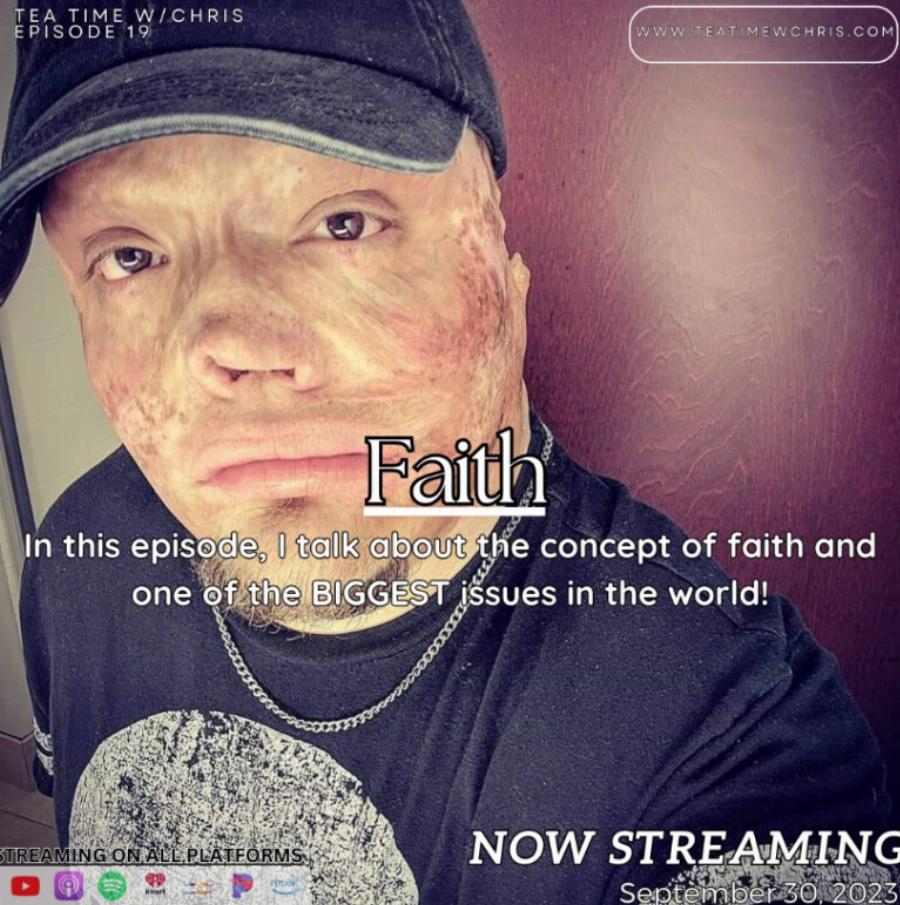 «Υπέστη έγκαυμα στο 98% του σώματός του ως παιδί, τον εγκατέλειψε η σύζυγός του»: Μεγάλωσε μόνος του τις 2 κόρες του