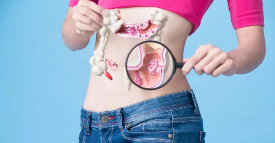 Πόσο καιρό χρειάζεται ένας πολύποδας του εντέρου για να εξελιχθεί σε καρκίνο