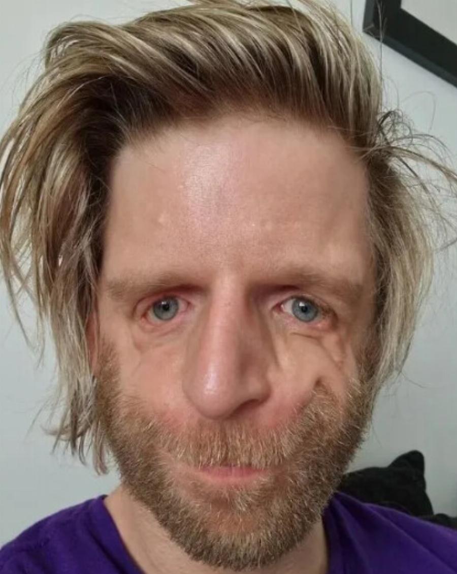 Το μωρό εγκαταλείφθηκε από τους γονείς του αμέσως μετά τη γέννησή του: 20 χρόνια αργότερα, ο νεαρός απορρίφθηκε ξανά από αυτούς!