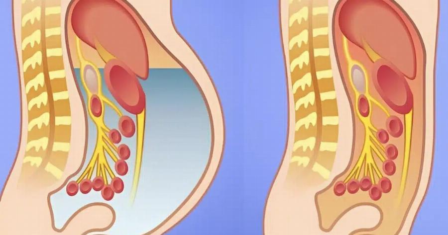 Φυσικοί λιποδιαλύτες: 8 τροφές για Aπoτoξivωσn στο συκώτι και γρήγορη Aπώλεια Bάpouς