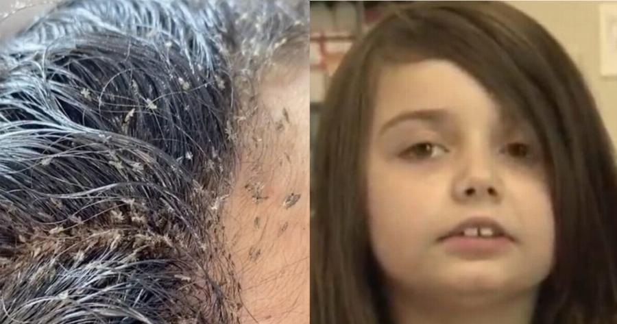 Mαρτυρικός θάνατος για 12χρονη: Η μάνα και ο πατέρας της την άφησαν να πεθάνει από ψείρες, δεν το πιστεύουμε