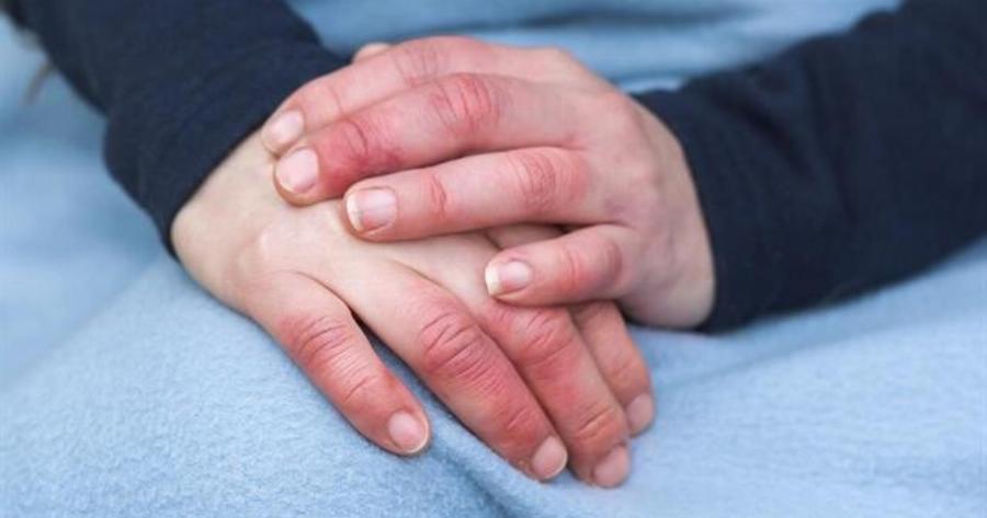 Οι γιατροί προειδοποιούν ότι αν έχετε συχνά κρύα χέρια τότε…
