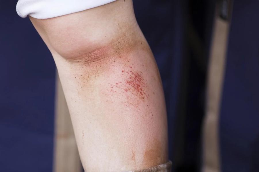 EKTAKTO – ΣYNAΓEPMOΣ TΩPA ΣTHN AΘHNA – EKKENΩNONTAI 5 ΣXOΛEIA