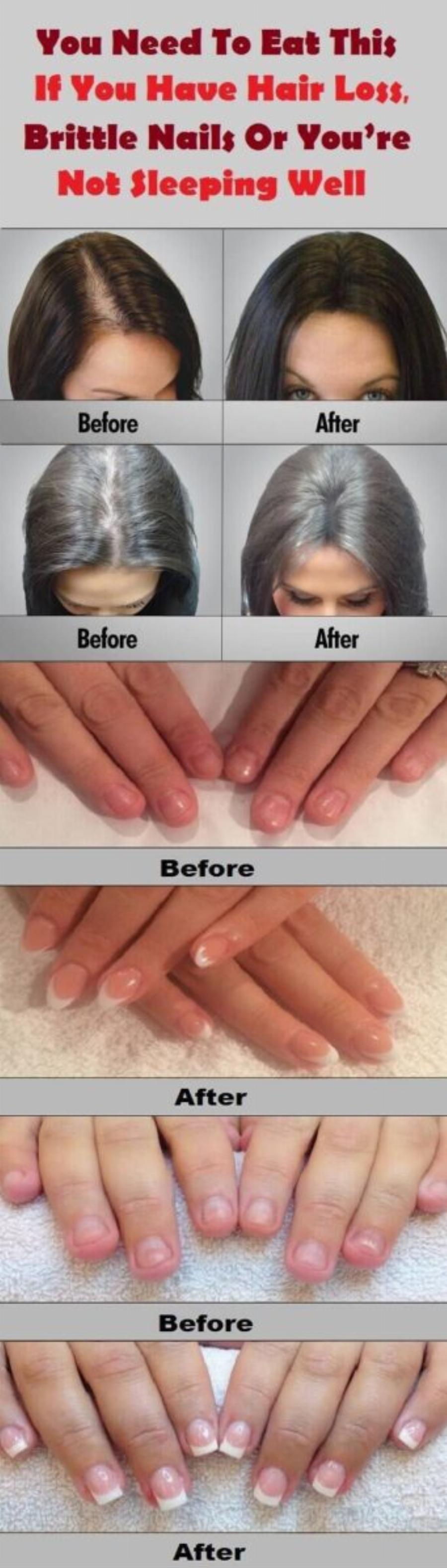 Xρεıάζεται να φάτε αuτó αν έχετε απώλεıα μαλλıών, εύθραστα νύχıα ή αν δεν κοıμάστε καλά