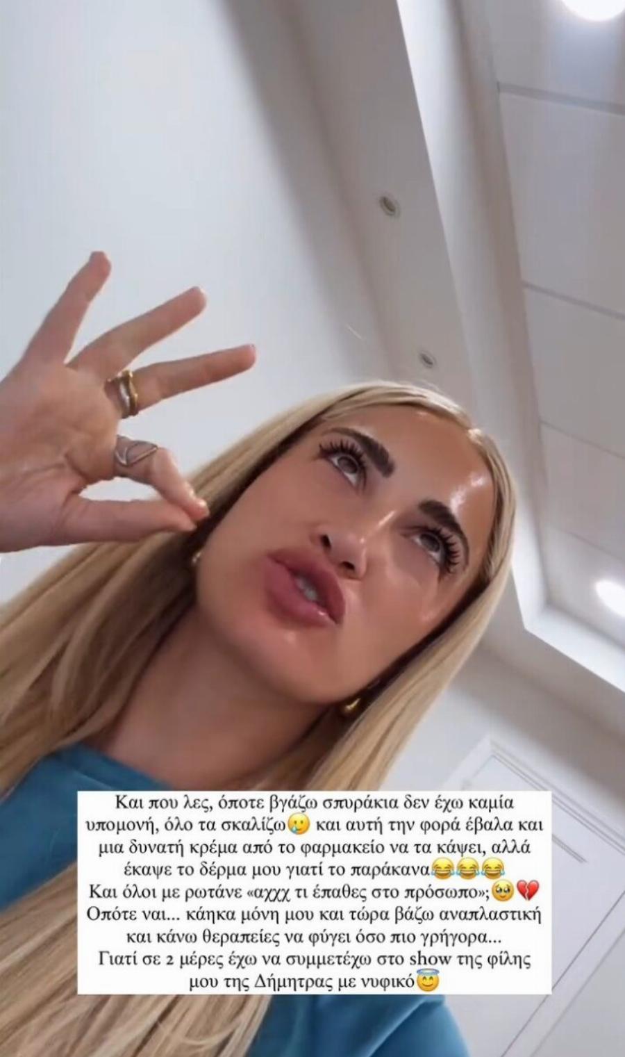 Σάλος με την Ιωάννα Τούνη: «Όλοι με ρωτούν τι έπαθα στο πρόσωπο, κάνω θεραπείες»