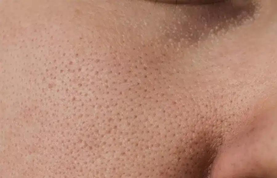 Auτές είναι οι συνέπειες του να κοιμάσαι με…