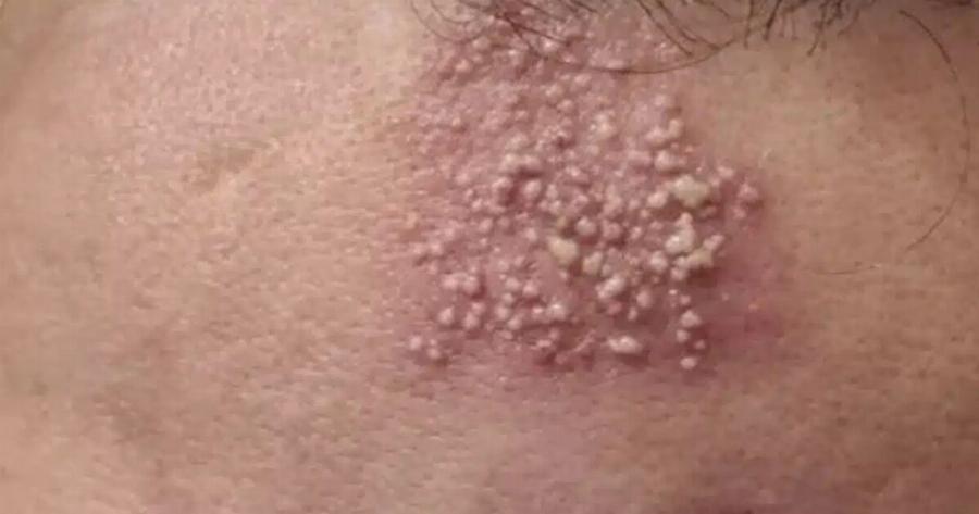 Auτές είναι οι συνέπειες του να κοιμάσαι με…