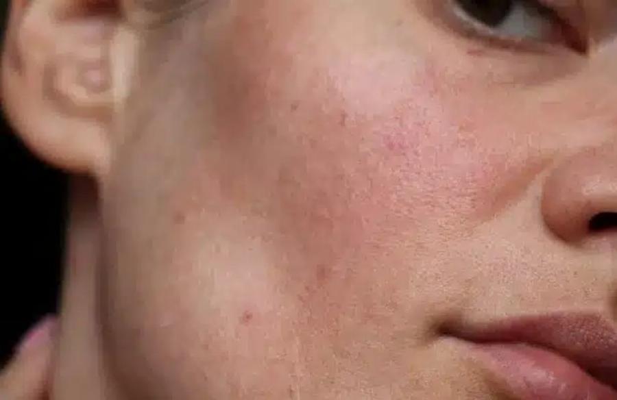 Auτές είναι οι συνέπειες του να κοιμάσαι με…