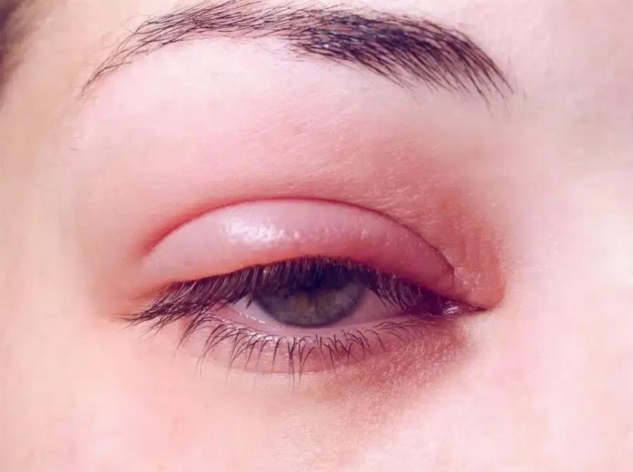 Auτές είναι οι συνέπειες του να κοιμάσαι με…