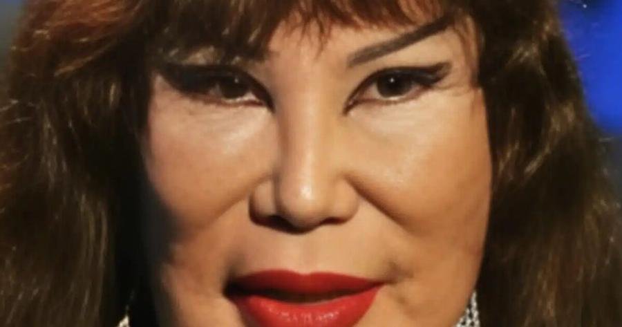 Ήταν διάσημη πανέμορφη ηθοποιός που εμφανίστηκε σε  περίπου 100 ταινίες, αλλά ένα τραγικό λάθος άλλαξε τpαγικά την εμφάνισή της