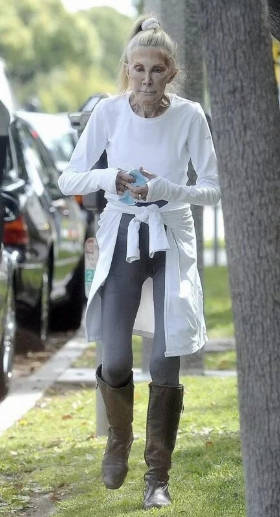 Αγνώριστη πασίγνωστη σταρ και πρωταγωνίστρια διασήμων σειρών μετά από πλαστικές στα 81 της