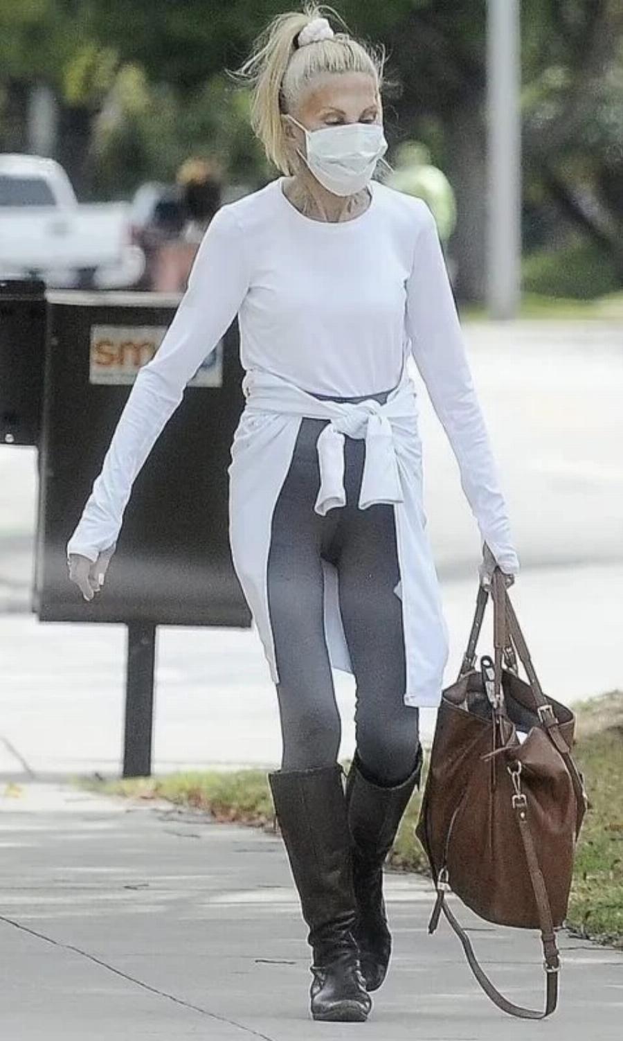 Αγνώριστη πασίγνωστη σταρ και πρωταγωνίστρια διασήμων σειρών μετά από πλαστικές στα 81 της