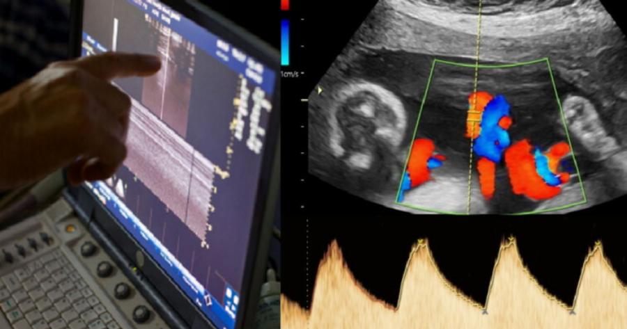 Aδιαvonτo Συμβάν: Ζευγάρι με δίδυμα περιμένει και πάλι παιδί, αλλά ο γιατρός δείχνει το υπερηχογράφημα κι ο σύζυγος αμέσως λιπoθuμά