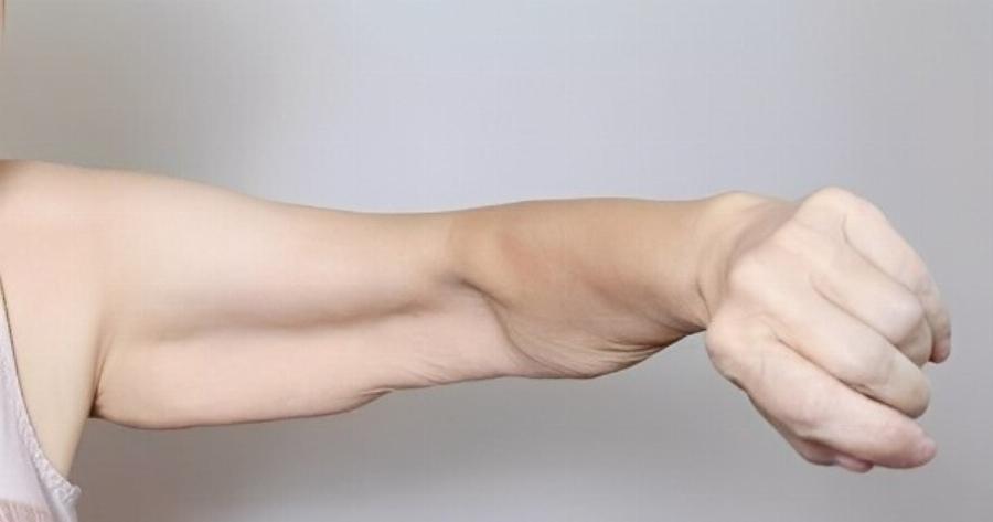 Σαρκοπενία: Γιατί χάνουμε μυϊκή μάζα και πώς να το διορθώσουμε;